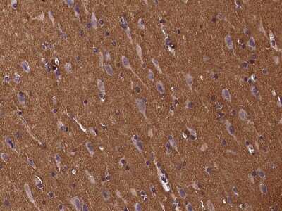 Immunohistochemistry-Paraffin: beta-Synuclein Antibody [NBP2-97152] - Immunochemical staining of human beta-Synuclein in human brain with rabbit polyclonal antibody at 1:300 dilution, formalin-fixed paraffin embedded sections.