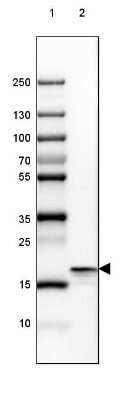 Western Blot: beta-Synuclein Antibody [NBP1-90342] - Lane 1: Marker [kDa] 250, 130, 100, 70, 55, 35, 25, 15, 10Lane 2: Human Cerebral Cortex tissue