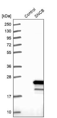 Western Blot: beta-Synuclein Antibody [NBP1-90342] - Analysis in control (vector only transfected HEK293T lysate) and SNCB over-expression lysate (Co-expressed with a C-terminal myc-DDK tag (3.1 kDa) in mammalian HEK293T cells).