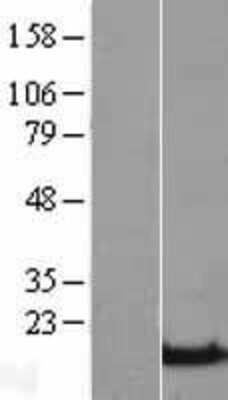 Western Blot beta-Synuclein Overexpression Lysate