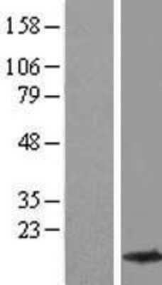 Western Blot beta-Synuclein Overexpression Lysate