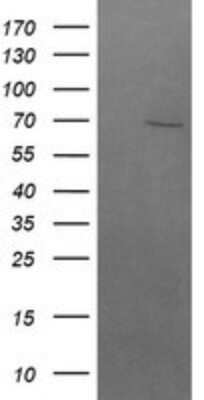 Western Blot: beta-TrCP1/BTRC Antibody (OTI2H2) - Azide and BSA Free [NBP2-71402] - Analysis of HEK293T cells were transfected with the pCMV6-ENTRY control (Left lane) or pCMV6-ENTRY BTRC.