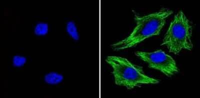 Immunocytochemistry/Immunofluorescence: beta Tubulin Antibody (BT7R) [NBP2-37830] - Analysis of Beta-Tubulin (green) showing staining in the in the cytoskeleton of Hela cells (right) compared to a negative control without primary antibody (left).