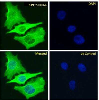 Immunocytochemistry/Immunofluorescence: beta Tubulin Antibody (S11B) [NBP2-81064] - Immunofluoresence staining of fixed HeLa cells with anti-Beta-tubulin antibody (S11B) [NBP2-81064]. Immunofluorescence analysis of paraformaldehyde fixed HeLa cells, permeabilized with 0.15% Triton stained with the chimeric rabbit IgG version of S11B [NBP2-81064] at 10 ug/ml for 1h followed by Alexa Fluor 488 secondary antibody (1 ug/ml), showing cytoplasmic staining. The nuclear stain is DAPI (blue). Panels show from left-right, top-bottom NBP2-81064, DAPI, merged channels and a negative control. The negative control was stained with unimmunized rabbit IgG followed by Alexa Fluor 488 secondary antibody.