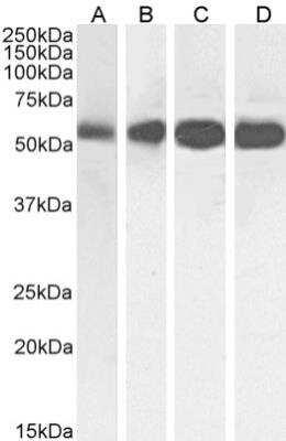 Western Blot: beta Tubulin Antibody (S11B) [NBP2-81064] - Western Blot using anti-Beta-Tubulin antibody (S11B) [NBP2-81064]. HeLa (A), A431 (B), HEK293 (C) and MCF-7 (D) cell lysate samples (35ug protein in RIPA buffer) were resolved on a 10% SDS PAGE gel and blots probed with the chimeric rabbit version of S11B [NBP2-81064] at 0.01 ug/ml before detection using an anti-rabbit secondary antibody. A primary incubation of 1h was used and protein was detected by chemiluminescence. The expected band size for Beta-Tubulin is ~54kDa. NBP2-81064 successfully detected human Beta-Tubulin in HeLa, A431, HEK293 and MCF-7 cell lysate samples.