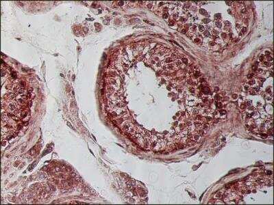 Immunohistochemistry-Paraffin: beta Tubulin Antibody (SAP.4G5) [NB120-11312] - Staining of formalin-fixed, paraffin-embedded human testis sections with Monoclonal Anti-beta-Tubulin I, Clone: SAP.4G5 using biotin/ExtrAvidin(R)-Peroxidase.