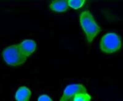 Immunocytochemistry/Immunofluorescence: beta Tubulin Antibody (SR25-04) [NBP2-67341] - Staining beta Tubulin in N2A cells (green). Cells were fixed in paraformaldehyde, permeabilised with 0.25% Triton X100/PBS.