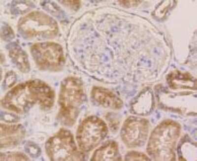 Immunohistochemistry-Paraffin: beta Tubulin Antibody (SR25-04) [NBP2-67341] - Analysis of paraffin-embedded human kidney tissue using anti-beta Tubulin antibody. Counter stained with hematoxylin.