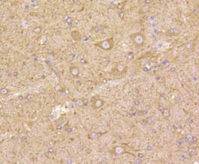 Immunohistochemistry-Paraffin: beta Tubulin Antibody (SR25-04) [NBP2-67341] - Analysis of paraffin-embedded mouse brain tissue using anti-beta Tubulin antibody. Counter stained with hematoxylin.
