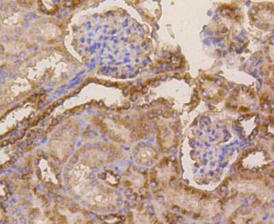 Immunohistochemistry-Paraffin: beta Tubulin Antibody (SR25-04) [NBP2-67341] - Immunohistochemical analysis of paraffin-embedded mouse kidney tissue using anti-beta Tubulin antibody. The section was pre-treated using heat mediated antigen retrieval with Tris-EDTA buffer (pH 8.0-8.4) for 20 minutes. The tissues were blocked in 5% BSA for 30 minutes at room temperature, washed with ddH2O and PBS, and then probed with the primary antibody (ET1602-4, 1/50) for 30 minutes at room temperature. The detection was performed using an HRP conjugated compact polymer system. DAB was used as the chromogen. Tissues were counterstained with hematoxylin and mounted with DPX.