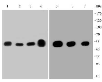 Western Blot: beta Tubulin Antibody (SR25-04) [NBP2-67341] - Western blot analysis of beta Tubulin on different lysates. Proteins were transferred to a PVDF membrane and blocked with 5% BSA in PBS for 1 hour at room temperature. The primary antibody (1/500) was used in 5% BSA at room temperature for 2 hours. Goat A