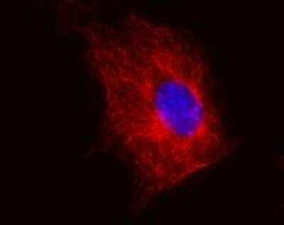 Immunocytochemistry/Immunofluorescence: beta Tubulin Antibody (TU-06) [NB120-7792] - Staining of 3T3 mouse embryonal fibroblast cell line using anti-beta-tubulin (TU-06) (detection by Goat anti-mouse IgM Cy(R)5). Nucleus is stained with DAPI (blue).