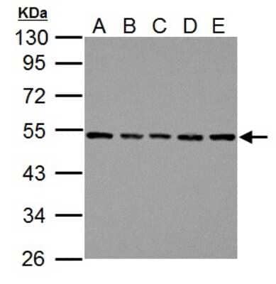 Western Blot: beta Tubulin Antibody [NBP2-15584] - Sample (30 ug of whole cell lysate) A: NIH-3T3, B: JC, C: BCL-1, D: C2C12, E: Raw264. 7 10% SDS PAGE NBP2-15584 diluted at 1:1000 .