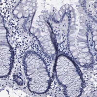 Immunohistochemistry-Paraffin: beta ureidopropionase Antibody [NBP1-89918] - Staining of human colon shows low expression as expected.