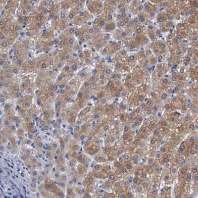 Immunohistochemistry-Paraffin: beta ureidopropionase Antibody [NBP1-89918] - Staining of human liver shows high expression.