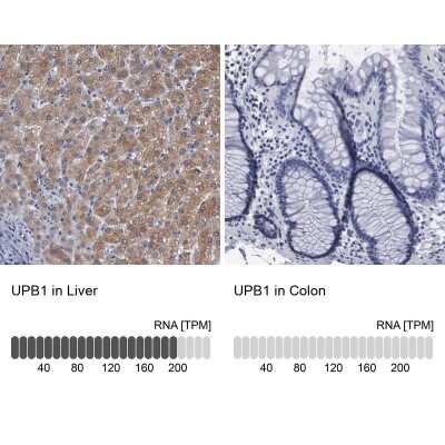 <b>Orthogonal Strategies Validation. </b>Immunohistochemistry-Paraffin: beta ureidopropionase Antibody [NBP1-89918] - Staining in human liver and colon tissues using anti-UPB1 antibody. Corresponding UPB1 RNA-seq data are presented for the same tissues.