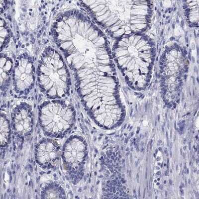 Immunohistochemistry-Paraffin: beta ureidopropionase Antibody [NBP3-17074] - Staining of human colon shows low expression as expected.