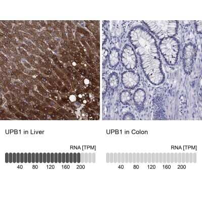 Immunohistochemistry-Paraffin: beta ureidopropionase Antibody [NBP3-17074] - Analysis in human liver and colon tissues using Anti-UPB1 antibody. Corresponding UPB1 RNA-seq data are presented for the same tissues.