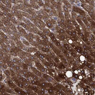 Immunohistochemistry-Paraffin: beta ureidopropionase Antibody [NBP3-17074] - Staining of human liver shows high expression.