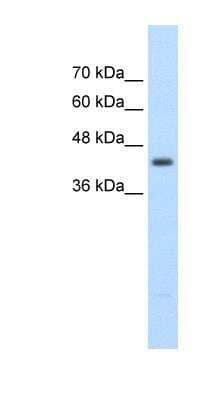 Western Blot: beta ureidopropionase Antibody [NBP1-54393] - Titration: 2.5ug/ml Positive Control: Jurkat cell lysate.