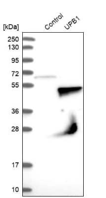 Western Blot: beta ureidopropionase Antibody [NBP1-89918] - Analysis in control (vector only transfected HEK293T lysate) and UPB1 over-expression lysate (Co-expressed with a C-terminal myc-DDK tag (3.1 kDa) in mammalian HEK293T cells).