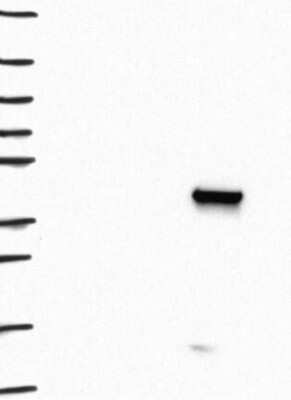 Western Blot: beta ureidopropionase Antibody [NBP3-17074] - Lane 1: Marker [kDa] 250, 130, 95, 72, 55, 36, 28, 17, 10;   Lane 2: RT4;   Lane 3: U-251 MG;   Lane 4: Human Plasma;   Lane 5: Liver;   Lane 6: Tonsil