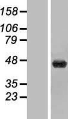 Western Blot: beta ureidopropionase Overexpression Lysate (Adult Normal) [NBP2-07056] Left-Empty vector transfected control cell lysate (HEK293 cell lysate); Right -Over-expression Lysate for beta ureidopropionase.