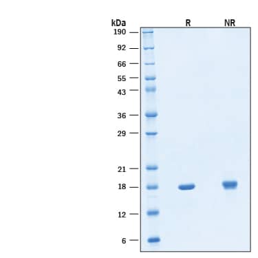 2 μg/lane of Recombinant Human IL‑18/IL‑1F4 GMP Protein (Catalog # BT-018-GMP) was resolved with SDS-PAGE under reducing (R)and non-reducing (NR) conditions and visualized by Coomassie® Blue staining, showing a band at 18 kDa under reducing conditions.