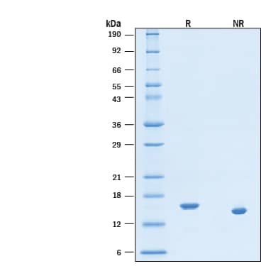 2 μg/lane of Recombinant Human IL-21 GMP Protein (Catalog # BT-021-GMP) was resolved with SDS-PAGE under reducing (R) and non-reducing (NR) conditions and visualized by Coomassie® Blue staining, showing bands at 15-17 kDa, under reducing conditions.