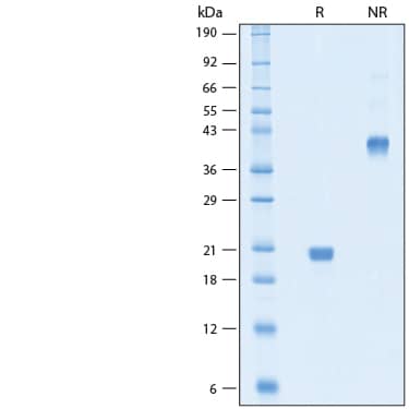 2 μg/lane of Recombinant Human VEGF 165 Protein (Catalog # BT-VEGF-AFL) was resolved with SDS-PAGE under reducing (R) and non-reducing (NR) conditions and visualized by Coomassie® Blue staining, showing bands at 19-21 kDa.