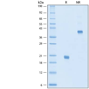 2 μg/lane of Recombinant Human VEGF 165 Protein (Catalog # BT-VEGF) was resolved with SDS-PAGE under reducing (R) and non-reducing (NR) conditions and visualized by Coomassie® Blue staining, showing bands at 19-21 kDa.