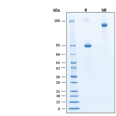 2 μg/lane of Recombinant Human Wnt/RSPO1 Agonist Protein (Catalog # BT-WRSP1) was resolved with SDS-PAGE under reducing (R) and non-reducing (NR) conditions and visualized by Coomassie® Blue staining, showing bands at 86-96 & >190 kDa under reducing conditions.