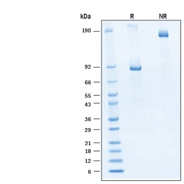 2 μg/lane of Recombinant Human Wnt/RSPO2 Agonist Protein (Catalog # BT-WRSP2) was resolved with SDS-PAGE under reducing (R) and non-reducing (NR) conditions and visualized by Coomassie® Blue staining, showing bands at 83-97 & >190 kDa under reducing conditions.