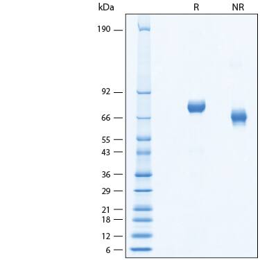 2 μg/lane of Recombinant Human IL-12 Biotinylated Protein (Catalog # BT10018) was resolved with SDS-PAGE under reducing (R) and non-reducing (NR) conditions and visualized by Coomassie® Blue staining, showing bands at 68-80 kDa.