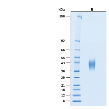 2 μg/lane of Biotinylated Recombinant Human TSLPR His-tag Protein (Catalog # BT10843) was resolved with SDS-PAGE under reducing (R) condition and visualized by Coomassie® Blue staining, showing bands at 37-47 kDa.