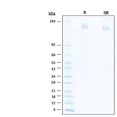 2 μg/lane of Biotinylated Recombinant SARS-CoV-2 B.1.1.529 Spike Protein (Catalog # BT11060) was resolved with SDS-PAGE under reducing (R) and non-reducing (NR) conditions and visualized by Coomassie® Blue staining, showing bands at 155-174 kDa.