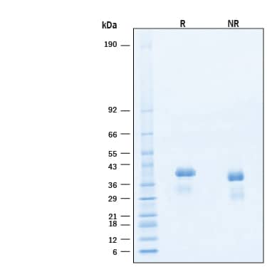 2 μg/lane of Biotinylated Recombinant Human R‑Spondin 1 Protein (Catalog # BT4645B) was resolved with SDS-PAGE under reducing (R) and non-reducing (NR) conditions and visualized by Coomassie® Blue staining, showing bands at 29‑42 kDa.