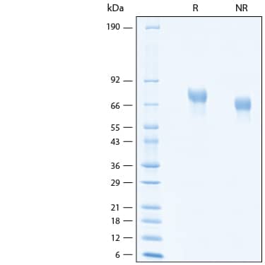 2 μg/lane of Recombinant Human LILRB1/CD85j/ILT2 His-tag Biotinylated Protein (Catalog # BT8989) was resolved with SDS-PAGE under reducing (R) and non-reducing (NR) conditions and visualized by Coomassie® Blue staining, showing bands at 68-79 kDa.
