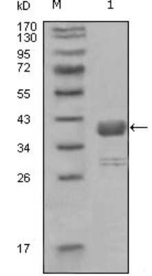 Western Blot: c-Abl Antibody (7B11D6) [NBP2-37679] - Western blot analysis using ABL1 mouse mAb against truncated GST-ABL1 recombinant protein (1).