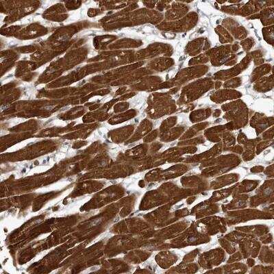 Immunohistochemistry-Paraffin: c-Abl Antibody [NBP1-90288] - Staining of human heart muscle shows strong cytoplasmic positivity in myocytes.