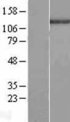 Western Blot: c Abl Overexpression Lysate (Adult Normal) [NBL1-07208] Left-Empty vector transfected control cell lysate (HEK293 cell lysate); Right -Over-expression Lysate for c Abl.