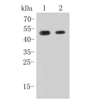 Western Blot: c-Fos Antibody (JJ0938) [NBP2-66775] - Analysis of c-Fos on different lysates. Proteins were transferred to a PVDF membrane and blocked with 5% BSA in PBS for 1 hour at room temperature. The primary antibody (1/500) was used in 5% BSA at room temperature for 2 hours. Goat Anti-Rabbit IgG - HRP Secondary Antibody at 1:200,000 dilution was used for 1 hour at room temperature. Positive control: Lane 1: NIH/3T3 cell lysateLane 2: MCF-7 cell lysate