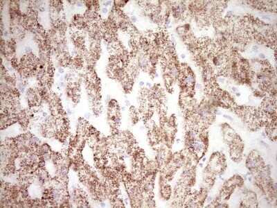 Immunohistochemistry: c-Fos Antibody (OTI7D6) - Azide and BSA Free [NBP2-70764] - Analysis of Human liver tissue. (Heat-induced epitope retrieval by 1 mM EDTA in 10mM Tris, pH8.5, 120C for 3min)