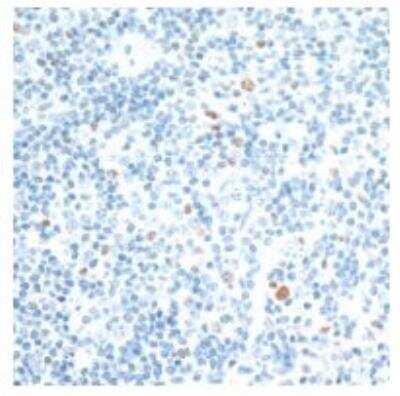 Immunohistochemistry: c-Maf Antibody [NBP3-14672] - Sample: FFPE section of human tonsil. Antibody: Rabbitanti-c-MAF recombinant monoclonal antibodyused at 1:125. Secondary: HRPconjugated goat anti-rabbit IgG. Substrate: DAB.