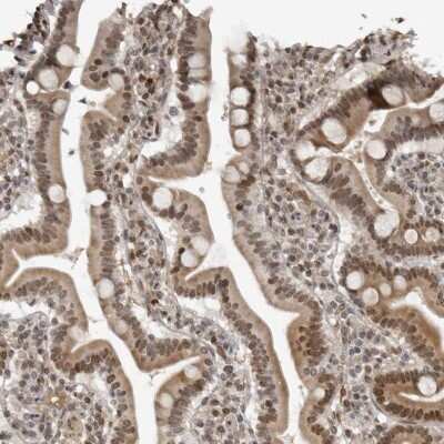 Immunohistochemistry-Paraffin: c-Maf Antibody [NBP1-88072] - Staining of human duodenum shows moderate nuclear and cytoplasmic positivity in glandular cells.