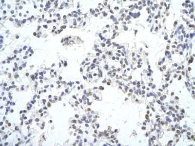 Immunohistochemistry-Paraffin: c-Maf Antibody [NBP3-10482] - Immunohistochemical analysis of paraffin-embedded human lung cell tissue.