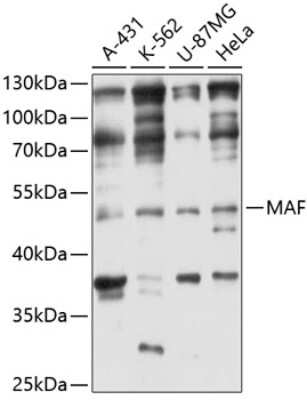 Western Blot: c-Maf Antibody [NBP2-92429] - Analysis of extracts of various cell lines, using c-Maf at 1:3000 dilution.Secondary antibody: HRP Goat Anti-Rabbit IgG (H+L) at 1:10000 dilution.Lysates/proteins: 25ug per lane.Blocking buffer: 3% nonfat dry milk in TBST.Detection: ECL Basic Kit .Exposure time: 5s.