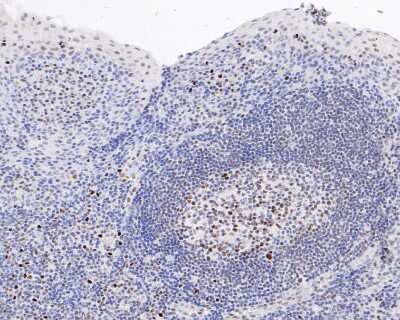 Immunohistochemistry-Paraffin: c-Myb [p Ser11] Antibody (SZ04-81) [NBP2-67368] - Immunohistochemical analysis of paraffin-embedded human tonsil tissue using anti-c-Myb antibody. The section was pre-treated using heat mediated antigen retrieval with sodium citrate buffer (pH 6.0) for 20 minutes. The tissues were blocked in 5% BSA for 30 minutes at room temperature, washed with ddH2O and PBS, and then probed with the primary antibody (ET1603-41, 1/200) for 30 minutes at room temperature. The detection was performed using an HRP conjugated compact polymer system. DAB was used as the chromogen. Tissues were counterstained with hematoxylin and mounted with DPX.