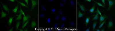 Immunocytochemistry/Immunofluorescence: c-Myc Antibody [Alexa Fluor® 488] [NB600-335AF488] - HeLa cells were fixed for 10 minutes using 10% formalin and then permeabilized for 5 minutes using 1X PBS + 0.5% Triton-X100.  The cells were incubated with anti-c-Myc conjugated to Alexa Fluor 488 [NB600-335AF488] at 20ug/ml for 1 hour at room temperature.  Nuclei were counterstained with DAPI (Blue).  Cells were imaged using a 40X objective.