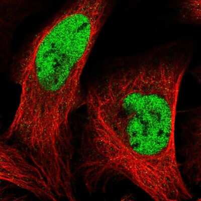 Immunocytochemistry/Immunofluorescence: c-Myc Antibody [NBP2-49201] - Immunofluorescent staining of human cell line U-2 OS shows localization to nucleoplasm. Antibody staining is shown in green.